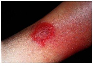 Морда болезнь