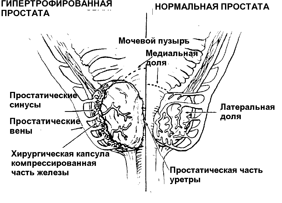 Размер простаты. Кровоснабжение предстательной железы анатомия. Гипертрофия предстательной железы Размеры. Хирургическая капсула предстательной железы. Предстательная железа размеры47х37х42.